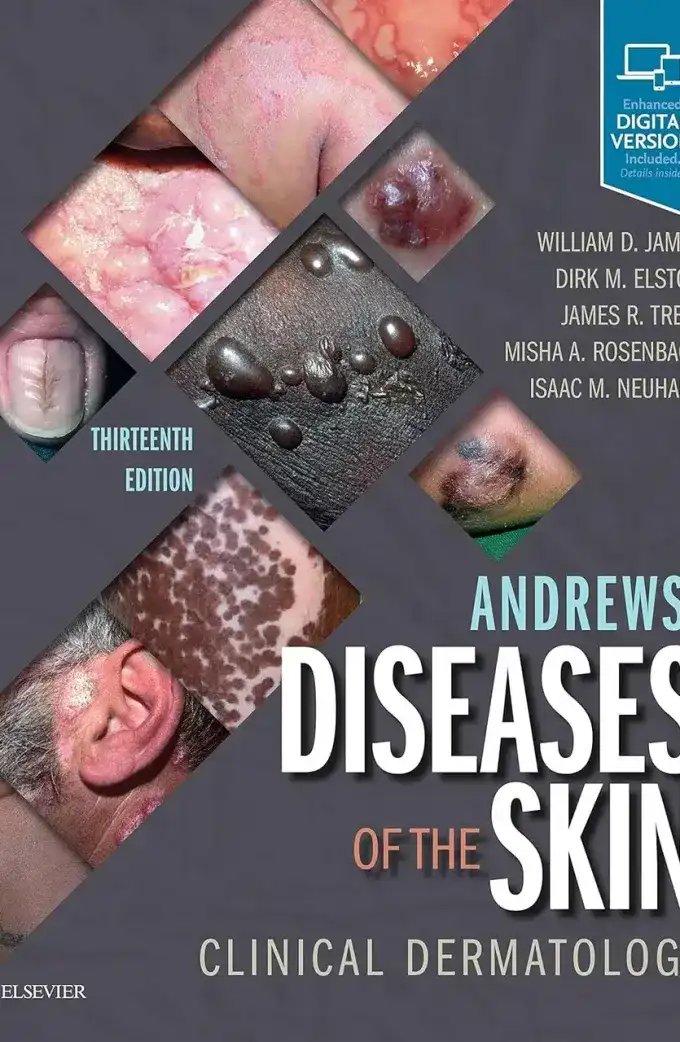 Andrews' Diseases Of The Skin