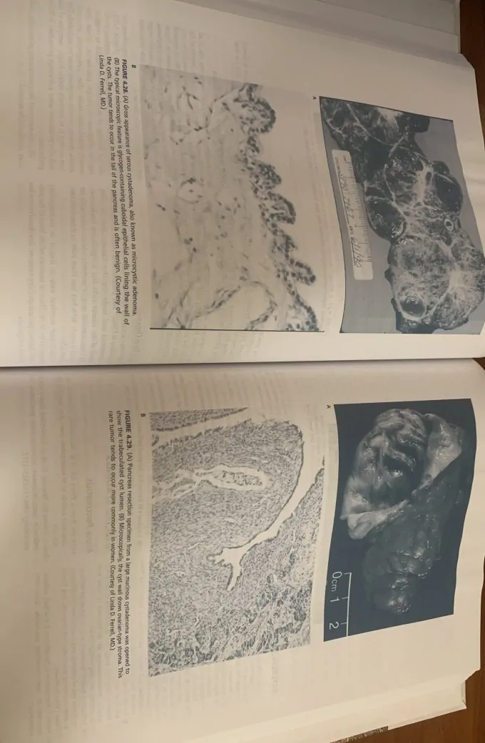 Gastrointestinal Surgery. Pathophysiology and Management