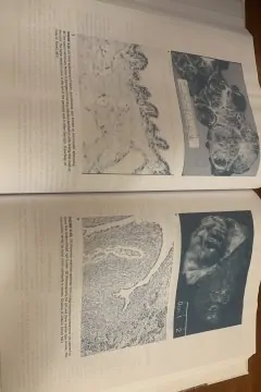 Gastrointestinal Surgery. Pathophysiology and Management