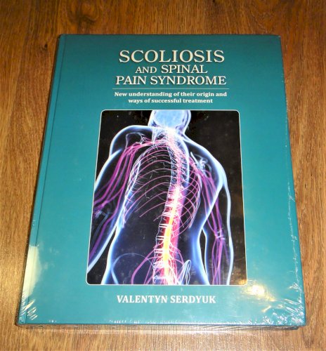 SCOLIOSIS and SPINAL PAIN SYNDROME